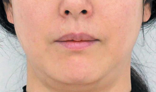 Oligio — Клиника эстетической медицины Major Beauty, г. Москва